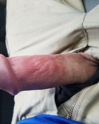 photo-thumb