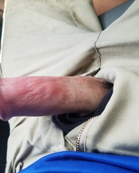 photo-thumb