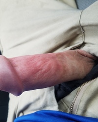 photo-thumb
